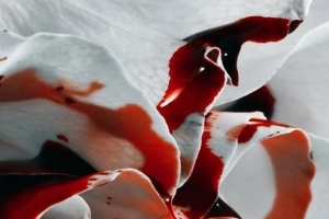 Come rimuovere le macchie di sangue secco dai vestiti