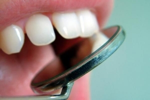 Cosa significa sognare che ti cadono i denti?